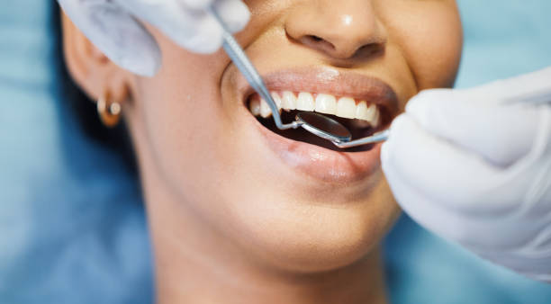 Best Pediatric Emergency Dentist in Church Hill, MD